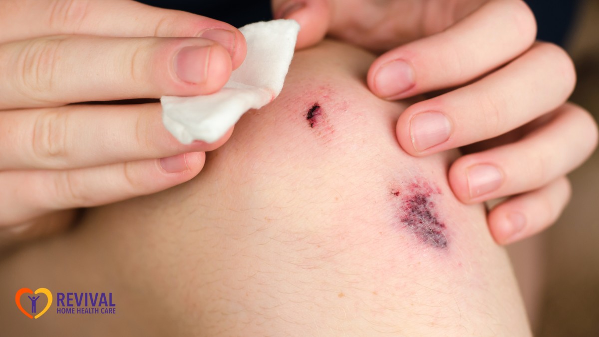 How to Help a Loved One With At-Home Wound Care