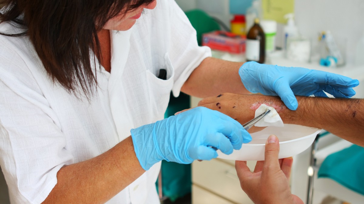 Tracking Progress: How Nurses Monitor Wound Healing