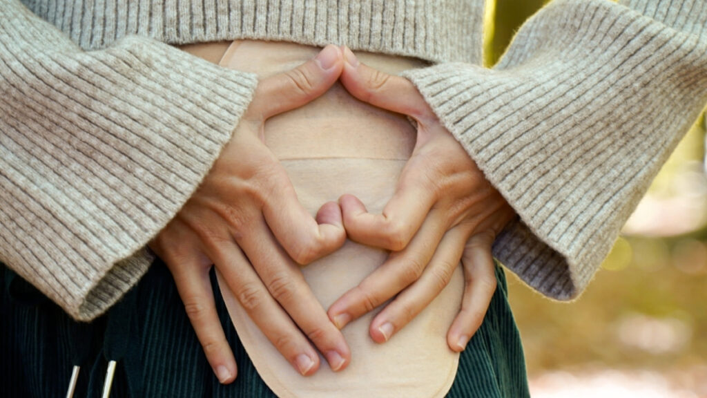 Living Comfortably With an Ostomy: Tips From Home Health Nurses