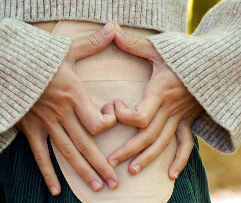 Living Comfortably With an Ostomy: Tips From Home Health Nurses
