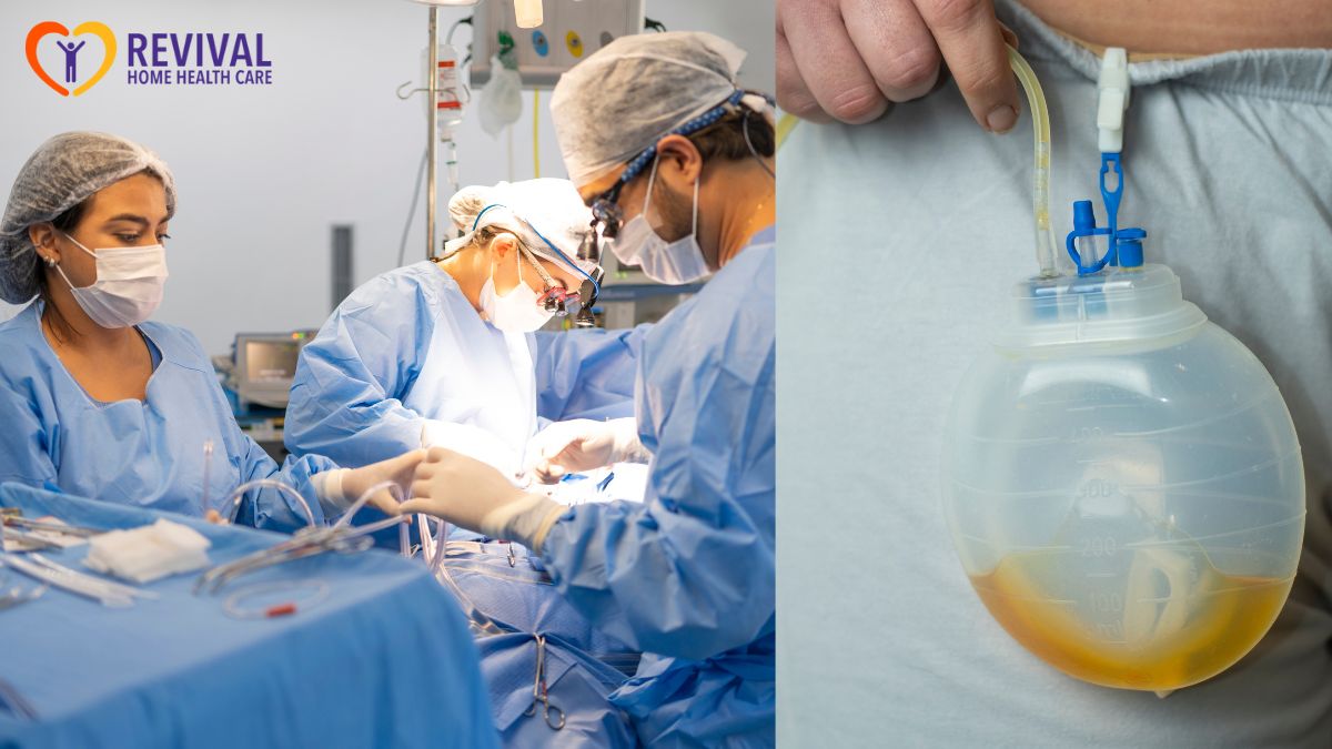 Drain Care at Home: JP Bulb Tips After Surgery