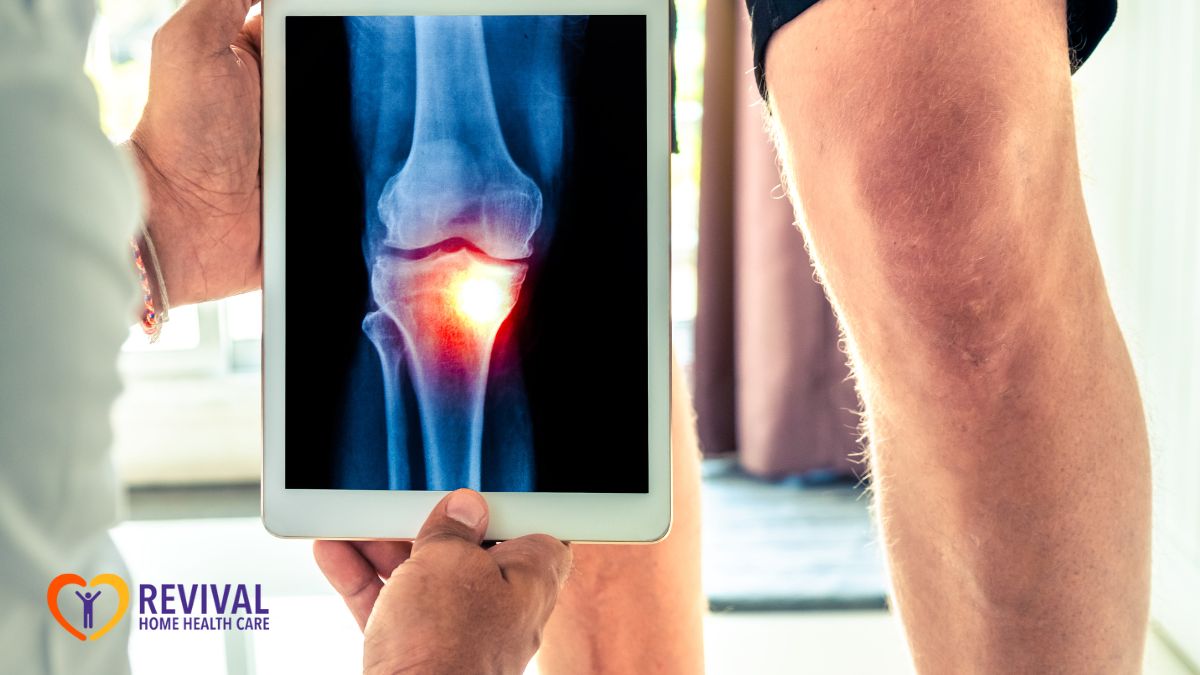 things-you-cant-do-after-knee-replacement